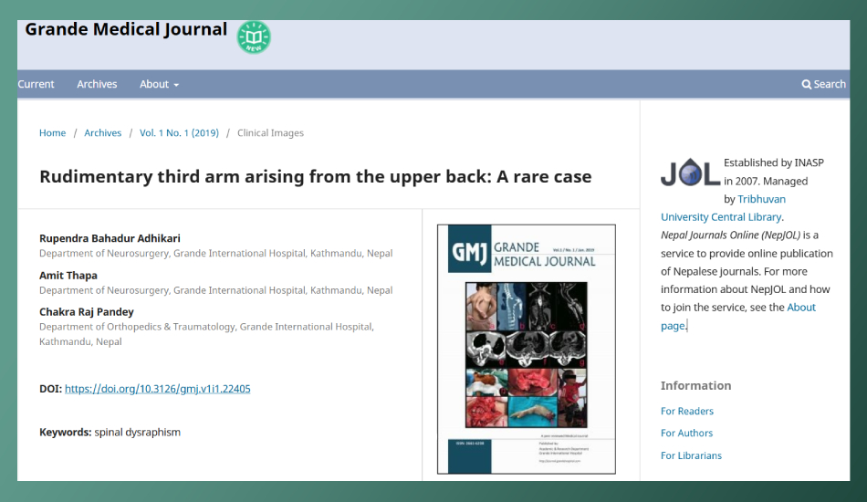 Rudimentary third arm arising from the upper back: A rare case